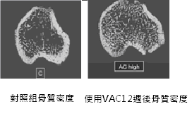 腦部下視丘調控機制